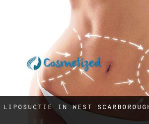 Liposuctie in West Scarborough