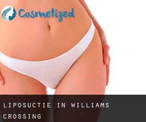 Liposuctie in Williams Crossing