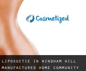 Liposuctie in Windham Hill Manufactured Home Community