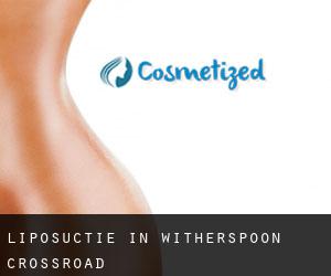 Liposuctie in Witherspoon Crossroad