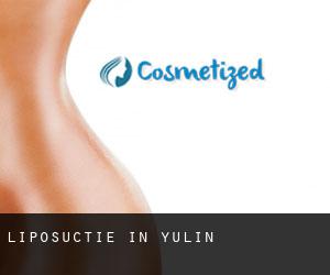 Liposuctie in Yulin