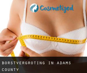 Borstvergroting in Adams County