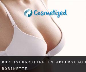 Borstvergroting in Amherstdale-Robinette