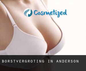 Borstvergroting in Anderson