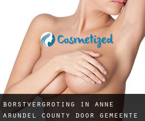 Borstvergroting in Anne Arundel County door gemeente - pagina 1
