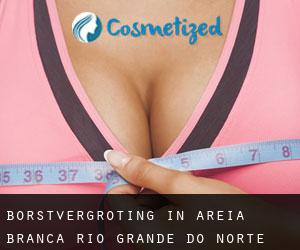 Borstvergroting in Areia Branca (Rio Grande do Norte)
