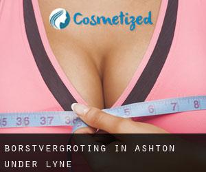 Borstvergroting in Ashton-under-Lyne