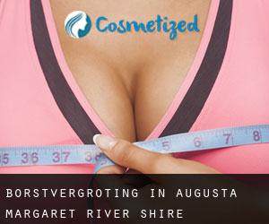 Borstvergroting in Augusta-Margaret River Shire