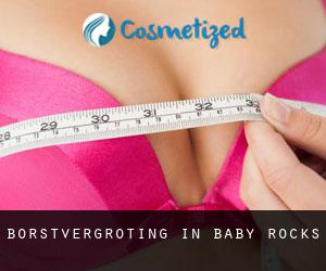 Borstvergroting in Baby Rocks