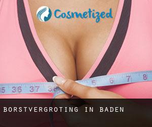 Borstvergroting in Baden