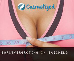 Borstvergroting in Baicheng Borstvergroting in Baicheng