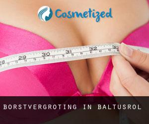 Borstvergroting in Baltusrol
