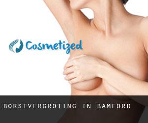 Borstvergroting in Bamford