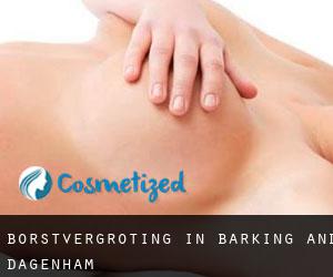 Borstvergroting in Barking and Dagenham