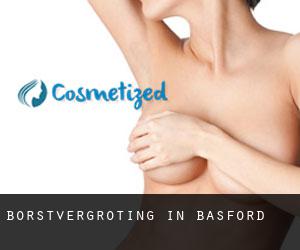 Borstvergroting in Basford