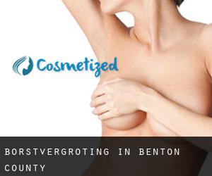 Borstvergroting in Benton County