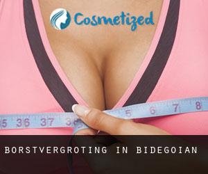 Borstvergroting in Bidegoian Borstvergroting in Bidegoian