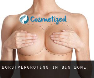 Borstvergroting in Big Bone