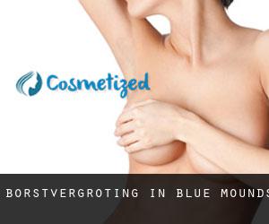 Borstvergroting in Blue Mounds