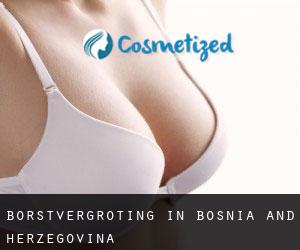 Borstvergroting in Bosnia and Herzegovina