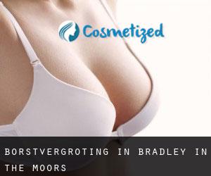 Borstvergroting in Bradley in the Moors