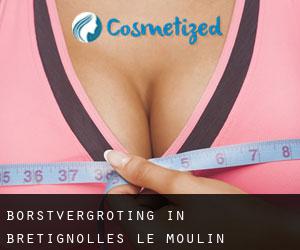 Borstvergroting in Brétignolles-le-Moulin