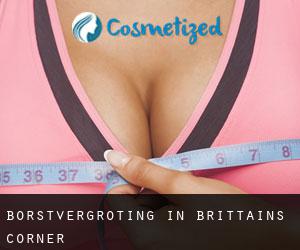 Borstvergroting in Brittains Corner