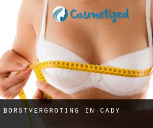 Borstvergroting in Cady