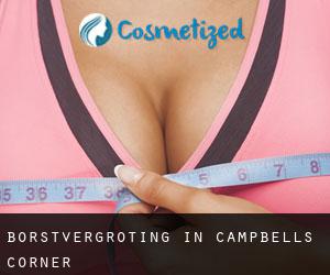 Borstvergroting in Campbells Corner