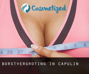 Borstvergroting in Capulin