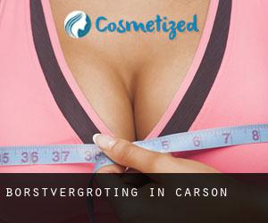 Borstvergroting in Carson