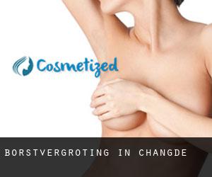 Borstvergroting in Changde Borstvergroting in Changde