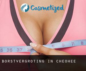Borstvergroting in Cheohee
