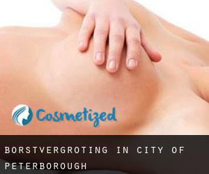 Borstvergroting in City of Peterborough