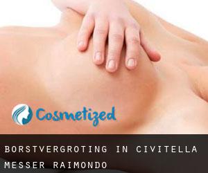 Borstvergroting in Civitella Messer Raimondo