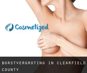 Borstvergroting in Clearfield County