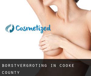 Borstvergroting in Cooke County