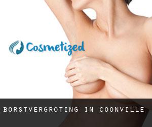 Borstvergroting in Coonville