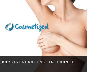 Borstvergroting in Council