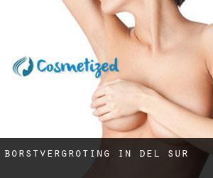 Borstvergroting in Del Sur