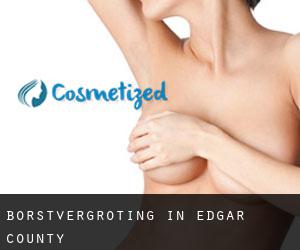 Borstvergroting in Edgar County