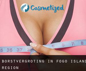 Borstvergroting in Fogo Island Region