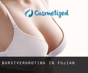 Borstvergroting in Fujian Borstvergroting in Fujian
