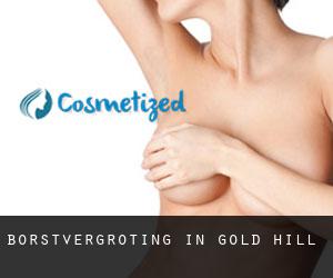 Borstvergroting in Gold Hill
