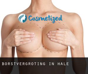 Borstvergroting in Hale