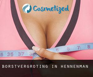Borstvergroting in Hennenman