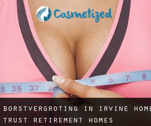 Borstvergroting in Irvine Home Trust Retirement Homes