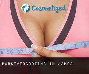 Borstvergroting in James