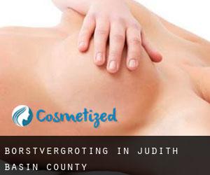 Borstvergroting in Judith Basin County
