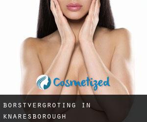 Borstvergroting in Knaresborough